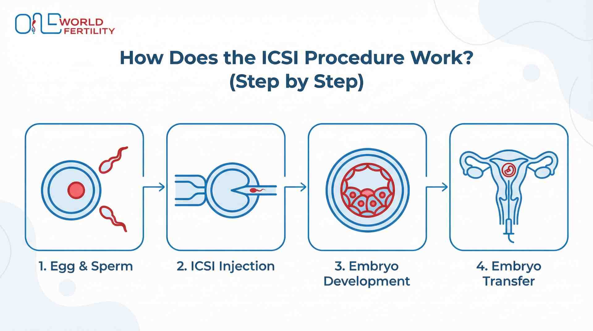 img_695769cc121f5_How_Does_the_ICSI_Procedure_Work_Step_by_Step-ONE_WORLD_FERTILITY.jpg