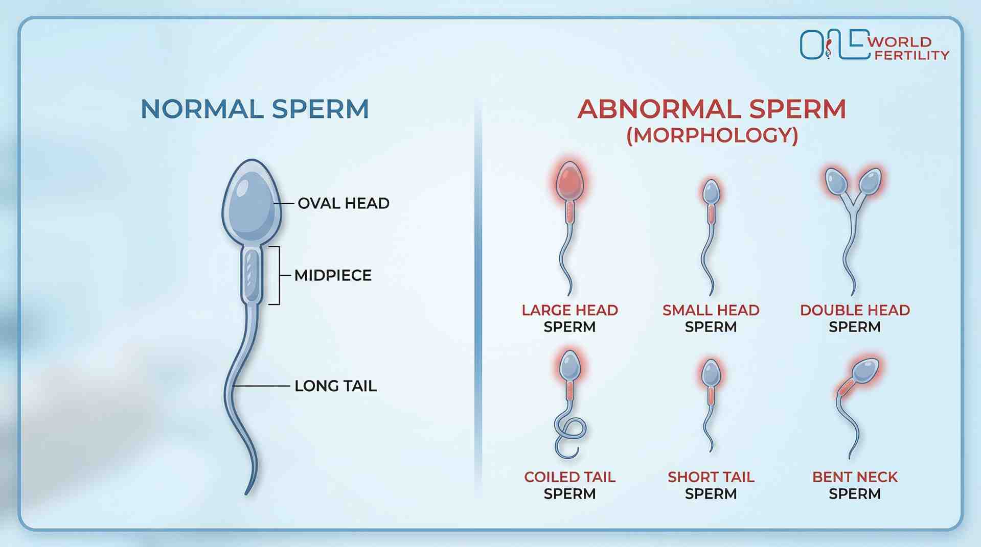 What Does Healthy Sperm Look Like?